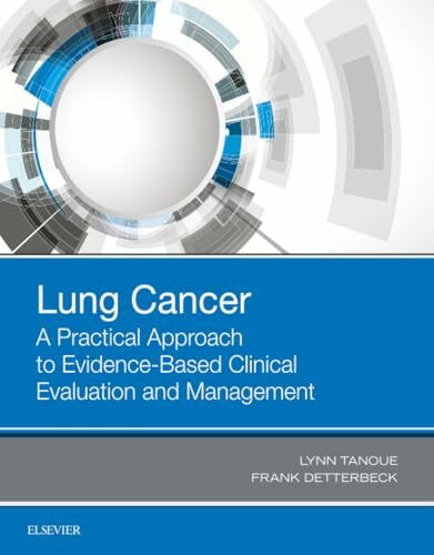 Lung Cancer: A Practical Approach to Evidence-Based Clinical Evaluation and Management