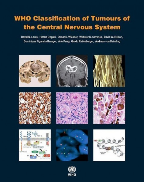 WHO Classification of Tumours of the Central Nervous System