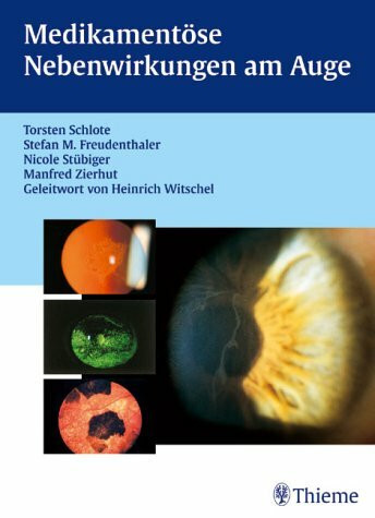 Medikamentöse Nebenwirkungen am Auge