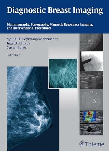 Diagnostic Breast Imaging: Mammography, Sonography, MRI and Interventional Procedures