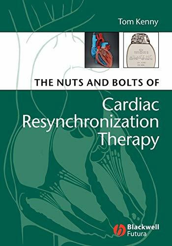 The Nuts and Bolts of Cardiac Resynchronization Therapy (Nuts and Bolts Series (Replaced by 5113))