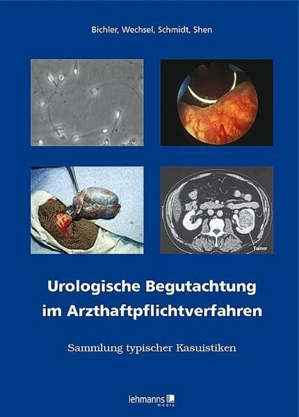 Urologische Begutachtung im Arzthaftpflichtverfahren: Sammlung typischer Kasuistiken