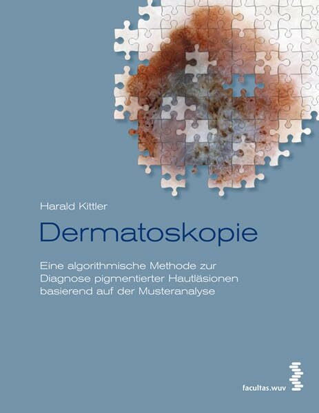 Dermatoskopie: Eine algorithmische Methode zur Diagnose pigmentierter Hautläsionen basierend auf der Musteranalyse