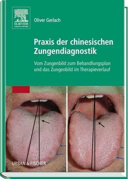 Praxis der chinesischen Zungendiagnostik: Vom Zungenbild zum Behandlungsplan und das Zungenbild im Therapieverlauf