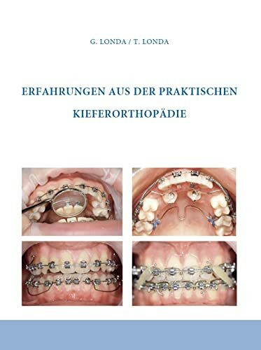 Erfahrungen aus der praktischen Kieferorthopädie