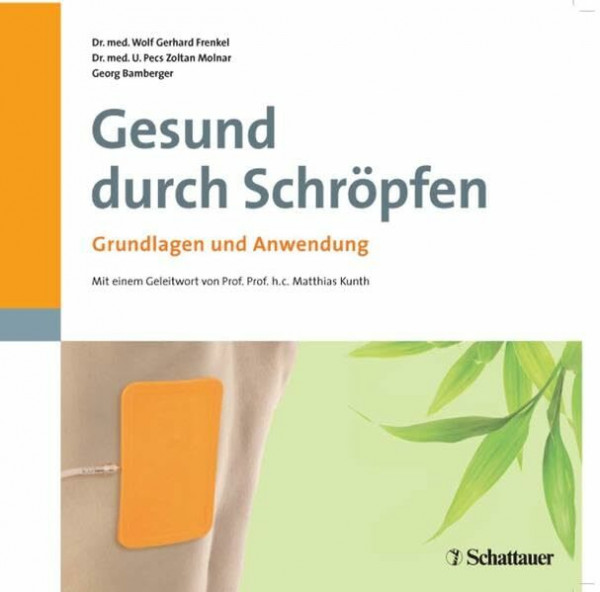 Gesund durch Schröpfen: Grundlagen und Anwendung: Grundlagen und Anwendung. Vorw. v. Matthias Kunth