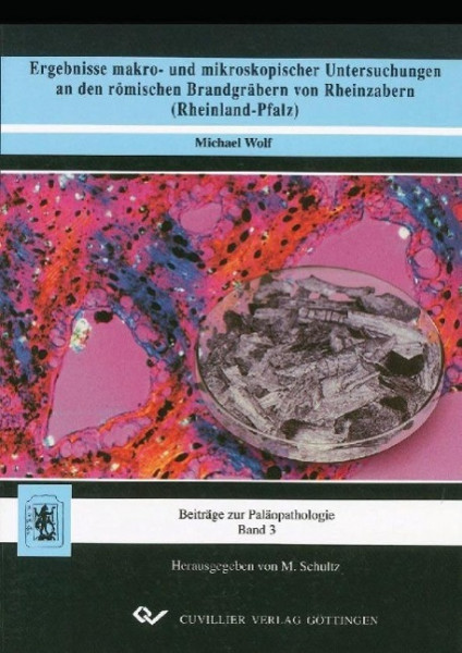 Ergebnisse makro- und mikroskopischer Untersuchungen an den römischen Brandgräbern von Rheinzabern (Rheinland-Pfalz)