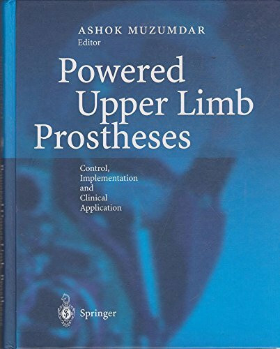 Powered Upper Limb Prostheses: Control, Implementation and Clinical Application