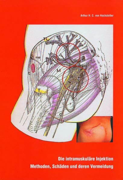 Die intramuskuläre Injektion: Methoden, Schäden und deren Vermeidung