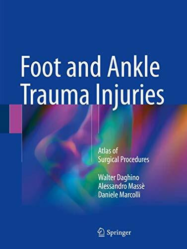 Foot and Ankle Trauma Injuries: Atlas of Surgical Procedures