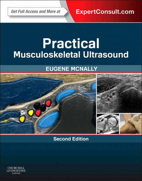 Practical Musculoskeletal Ultrasound: Expert Consult - Online and Print