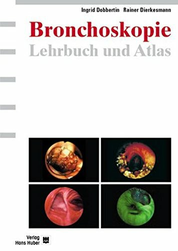 Bronchoskopie