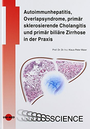 Autoimmunhepatitis, Overlapsyndrome, primär sklerosierende Cholangitis und primär biliäre Zirrhose in der Praxis