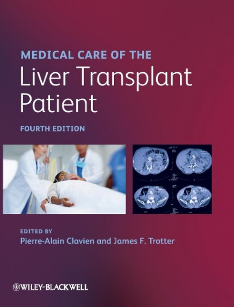 Medical Care of the Liver Transplant Patient