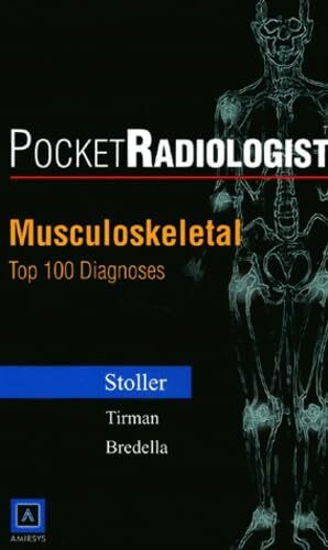 Musculoskeletal: Top 100 Diagnoses (Pocket Radiologist)