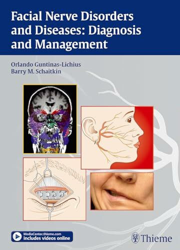 Facial Nerve Disorders and Diseases: Diagnosis and Management: Includes videos online