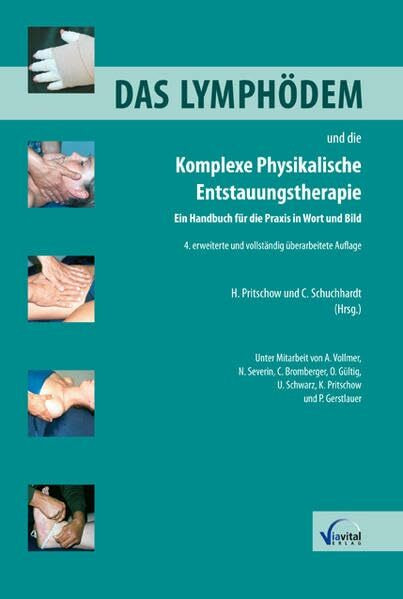 Das Lymphödem und die Komplexe Physikalische Entstauungstherapie: Ein Handbuch für die Praxis in Wort und Bild
