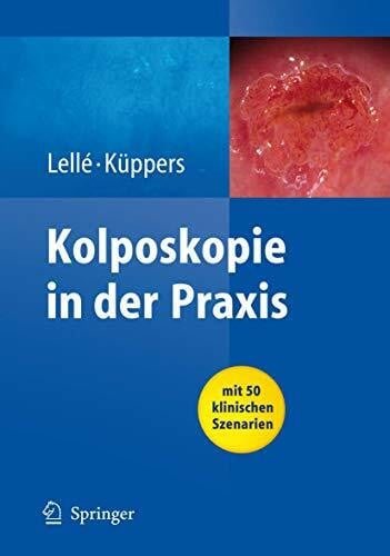 Kolposkopie in der Praxis: Mit 50 klinischen Szenarien