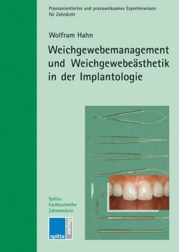 Weichgewebemanagement und Weichgewebeästhetik in der Implantologie