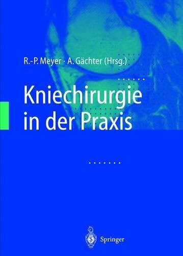 Kniechirurgie in der Praxis