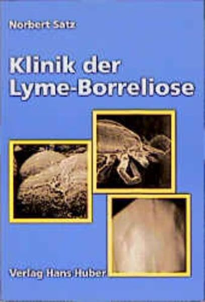 Klinik der Lyme-Borreliose