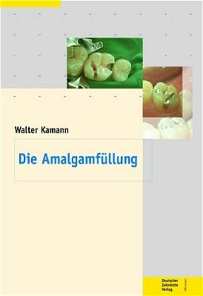 Die Amalgamfüllung