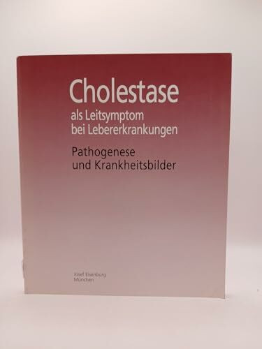Cholestase als Leitsymptom bei Lebererkrankungen. Pathogenese und Krankheitsbilder
