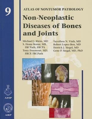 Klein, M: Non-Neoplastic Diseases of Bones and Joints