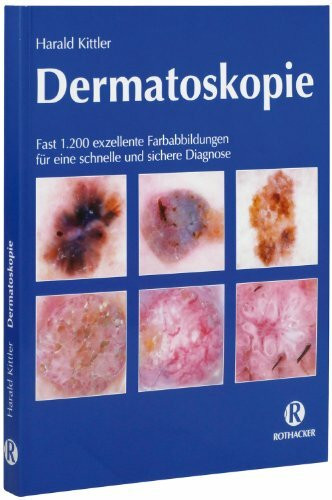 Dermatoskopie