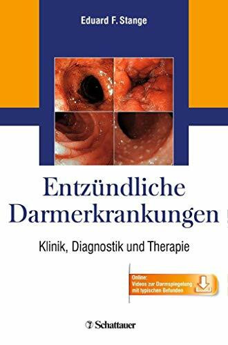 Entzündliche Darmerkrankungen: Klinik, Diagnostik und Therapie - Online: Videos zur Darmspiegelung mit typischen Befunden