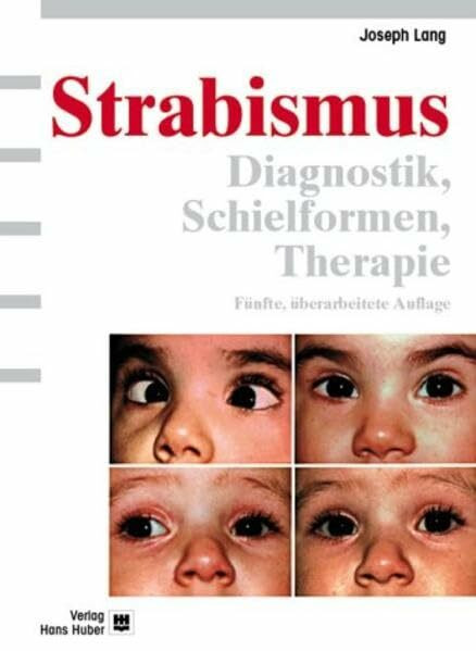 Strabismus: Diagnostik, Schielformen, Therapie