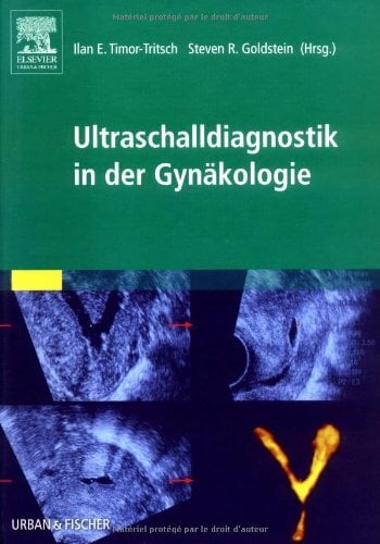 Ultraschalldiagnostik in der Gynäkologie Ultraschalldiagnostik in der Gynäkologie
