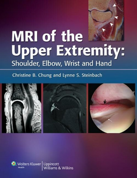 MRI of Upper Extremity: Shoulder, Elbow, Wrist, and Hand