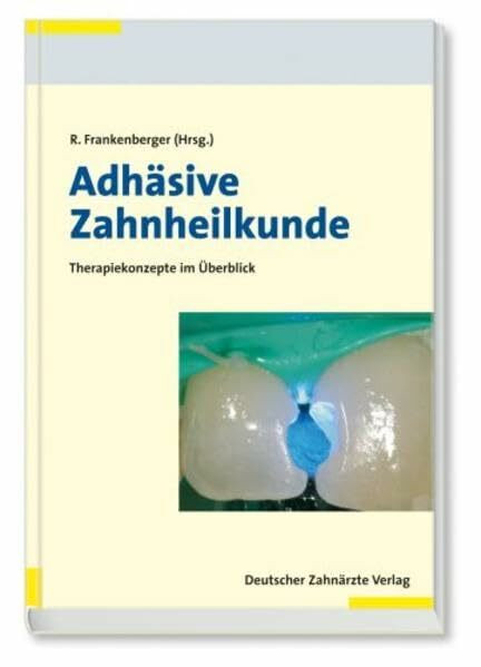 Adhäsive Zahnheilkunde: Wissenschaft und Praxis