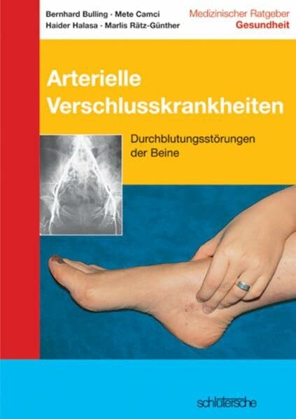 Arterielle Verschlusskrankheiten: Durchblutungsstörungen der Beine