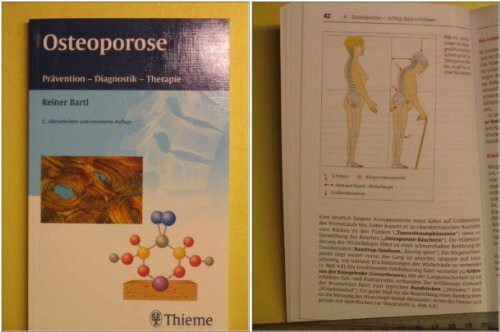 Osteoporose: Prävention - Diagnostik - Therapie