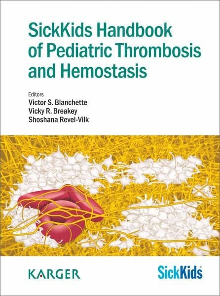 SickKids Handbook of Pediatric Thrombosis and Hemostasis: Now available: 2nd, revised edition SickKids Handbook of Pediatric Thrombosis and Hemostasis
