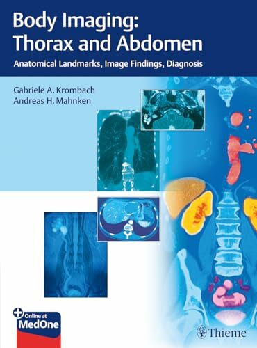 Body Imaging: Thorax and Abdomen: Anatomical Landmarks, Image Findings, Diagnosis