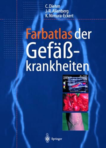 Farbatlas der Gefäßkrankheiten