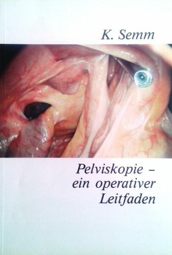 Pelviskopie - ein operativer Leitfaden