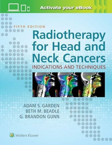 Radiotherapy for Head and Neck Cancers: Indications and Techniques