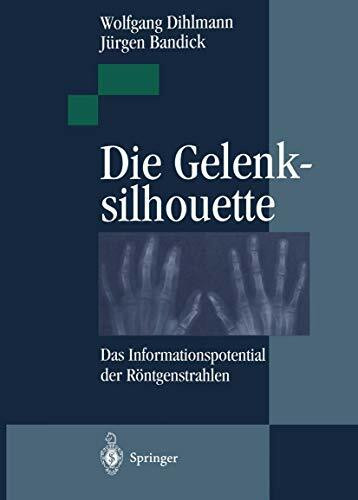 Die Gelenksilhouette: Das Informationspotential der Röntgenstrahlen