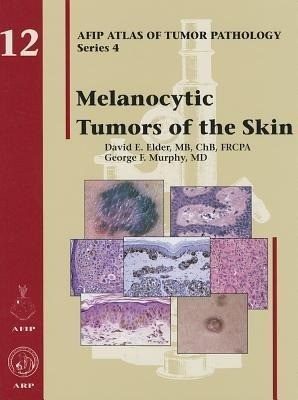 Elder, D: Melanocytic Tumors of the Skin