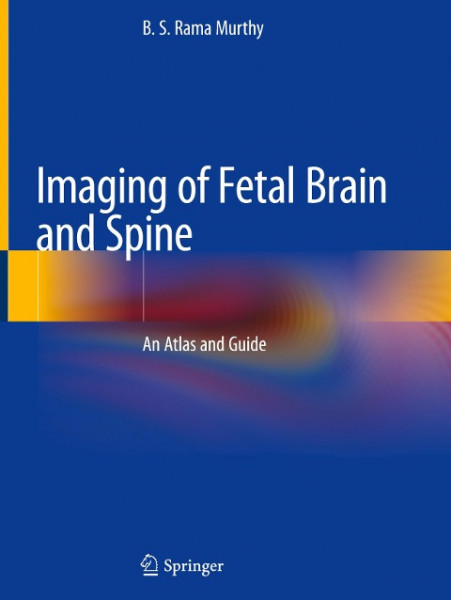 Imaging of Fetal Brain and Spine