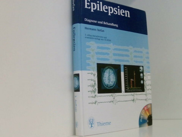 Epilepsien: Diagnose und Behandlung